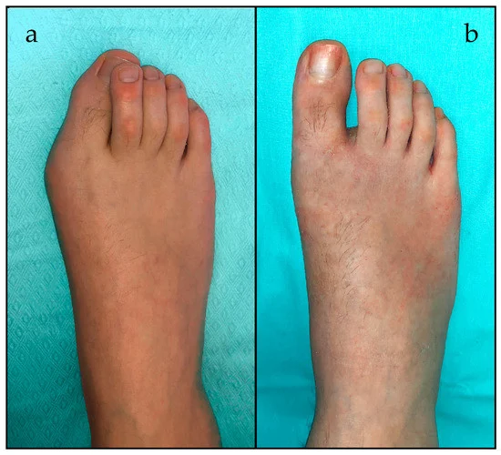 children 10 00094 g002 550